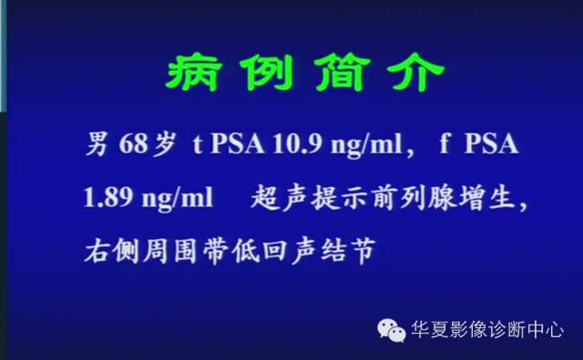 DWI序列之：在前列腺癌中的应用