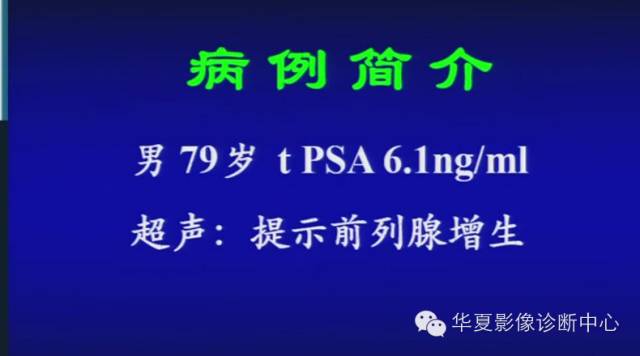 DWI序列之：在前列腺癌中的应用