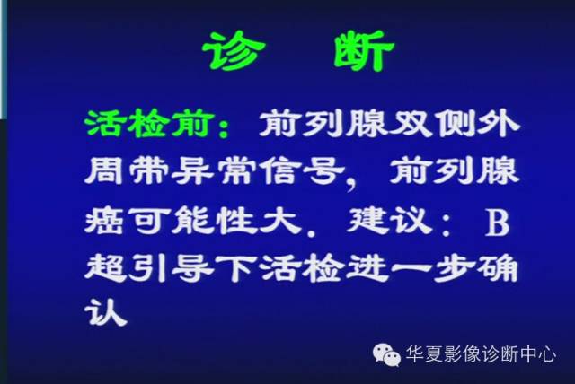DWI序列之：在前列腺癌中的应用