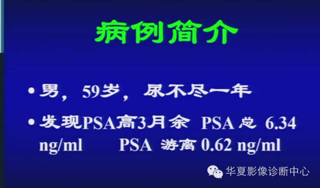 DWI序列之：在前列腺癌中的应用
