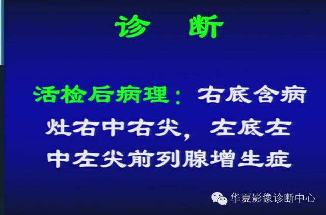 DWI序列之：在前列腺癌中的应用