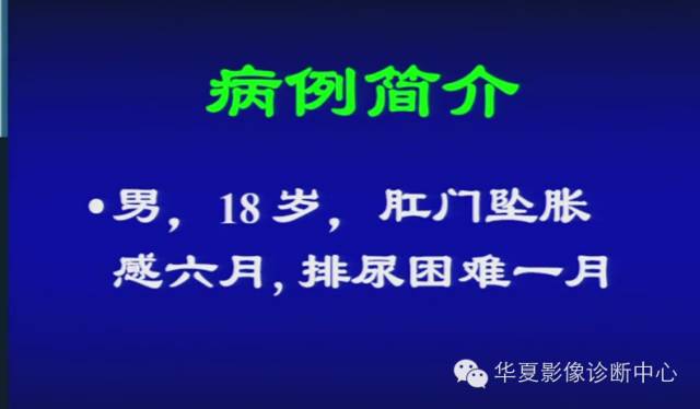DWI序列之：在前列腺癌中的应用