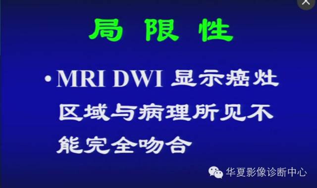 DWI序列之：在前列腺癌中的应用