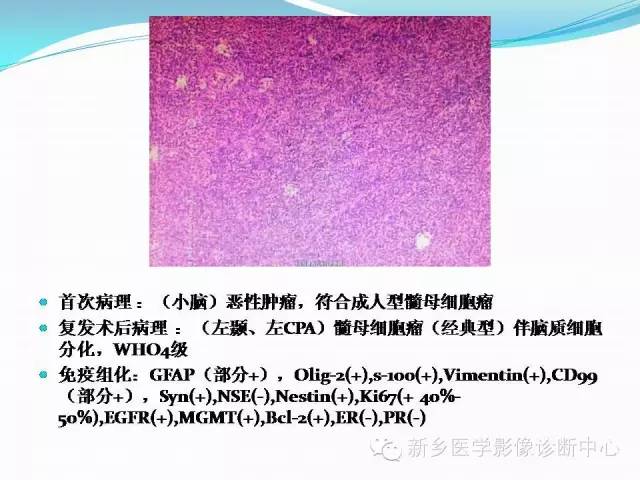 【病例】成人小脑髓母细胞瘤1例影像表现