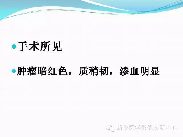 【病例】脑室海绵状血管瘤1例MR影像表现
