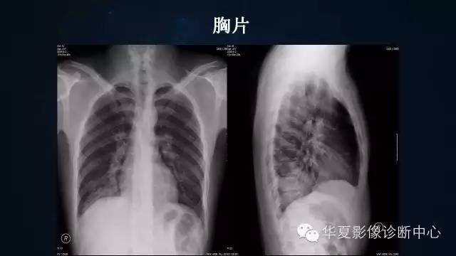 【病例】