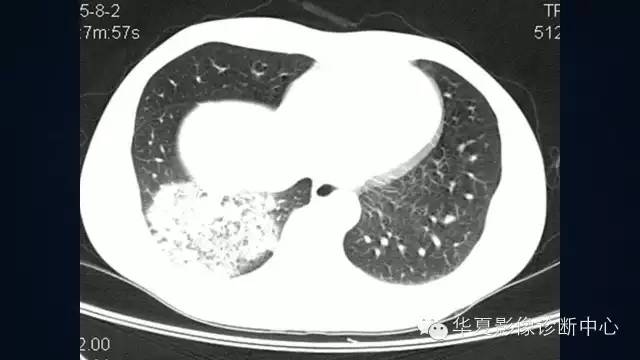 【病例】
