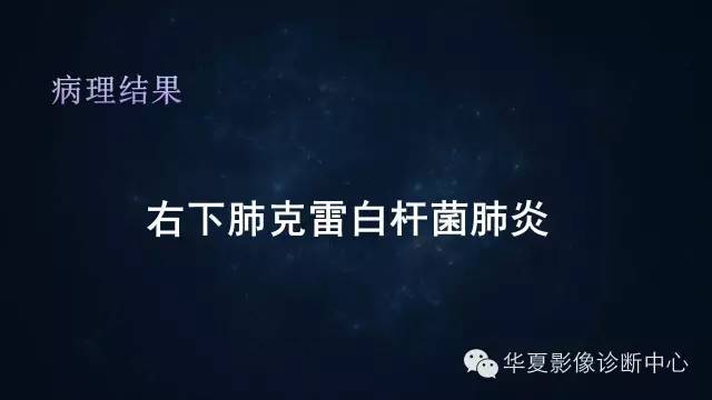【病例】