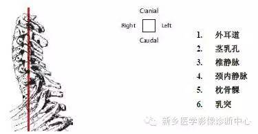 颈椎精细解剖+详细标注
