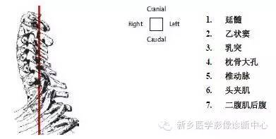 颈椎精细解剖+详细标注