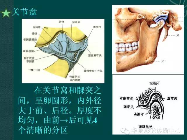 【PPT】颞下颌关节紊乱病