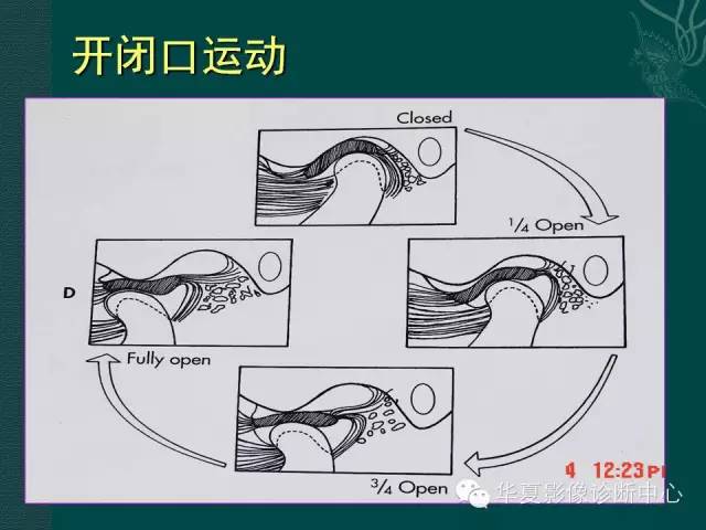 【PPT】颞下颌关节紊乱病