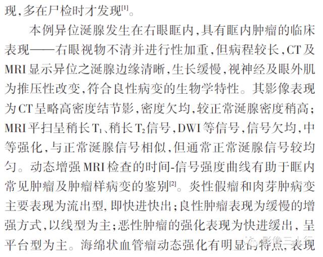 【病例】右眼眶内异位涎腺组织一例影像表现 【病例】右眼眶内异位涎腺组织一例影像表现