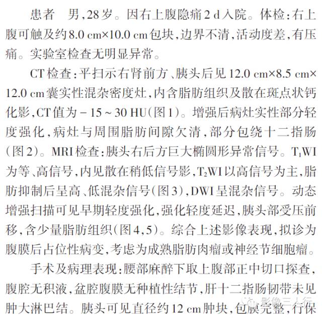 【病例】胰头巨大血管淋巴管瘤一例影像表现 【病例】胰头巨大血管淋巴管瘤一例影像表现