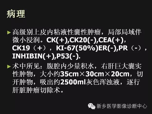 【病例】肝脏粘液性囊性肿瘤1例CT影像表现