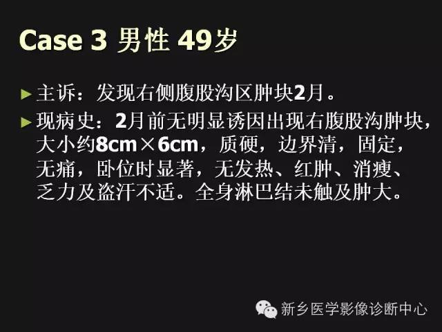 【病例】外周性PNET一例CT影像表现