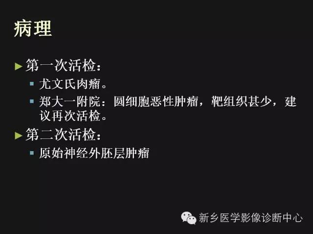 【病例】外周性PNET一例CT影像表现