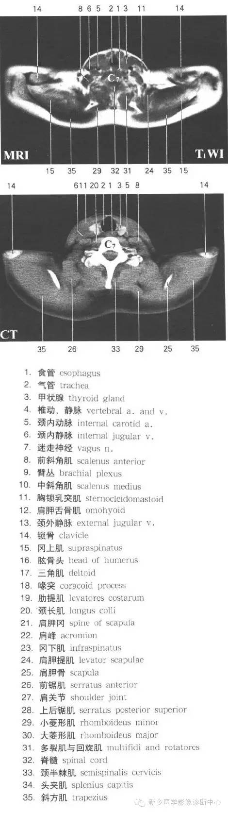 胸部横断位解剖+详细标注