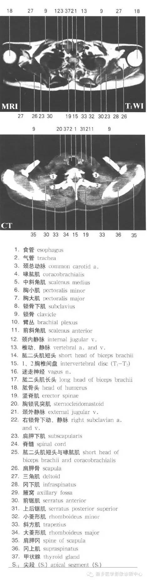 胸部横断位解剖+详细标注