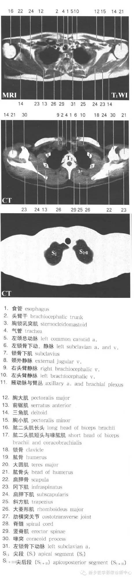 胸部横断位解剖+详细标注