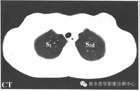胸部横断位解剖+详细标注