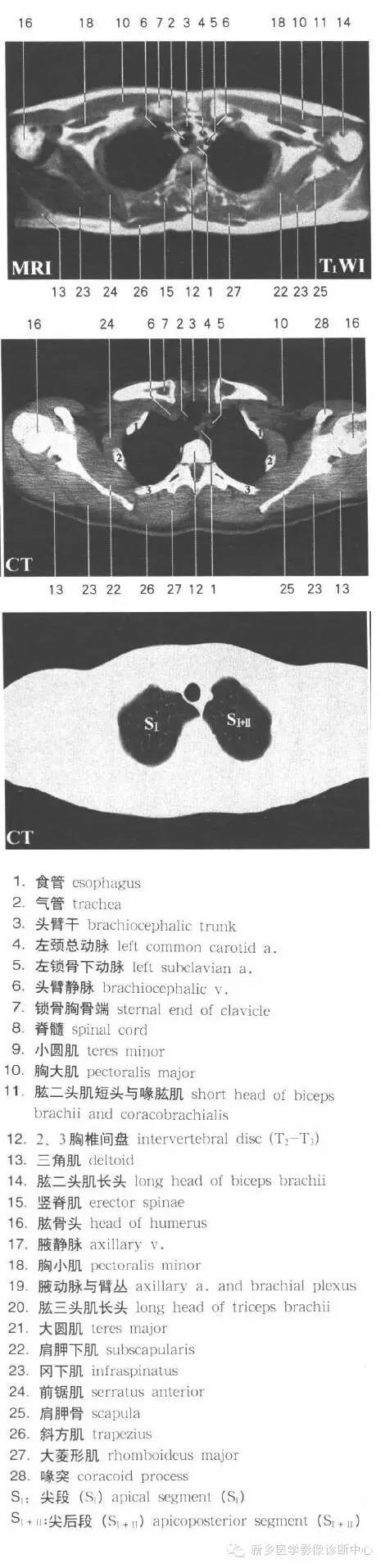 胸部横断位解剖+详细标注