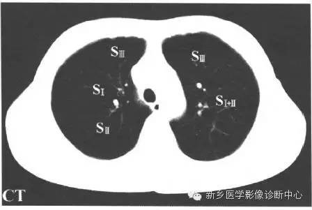 胸部横断位解剖+详细标注