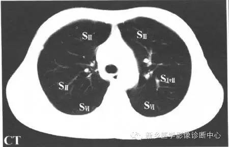 胸部横断位解剖+详细标注
