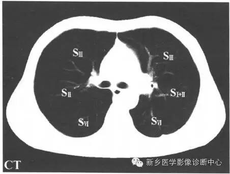 胸部横断位解剖+详细标注