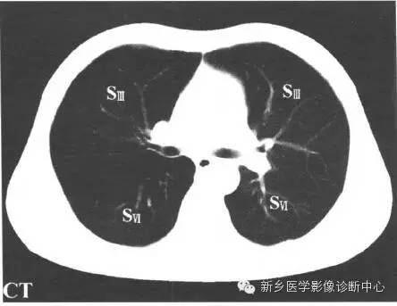 胸部横断位解剖+详细标注