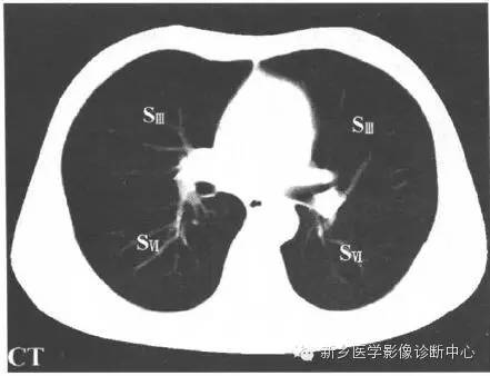 胸部横断位解剖+详细标注