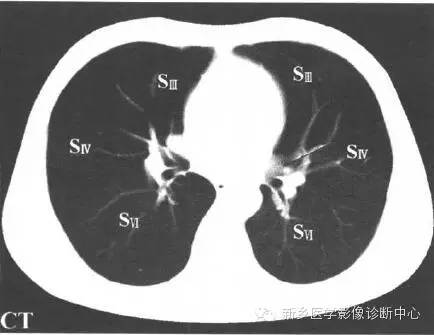 胸部横断位解剖+详细标注