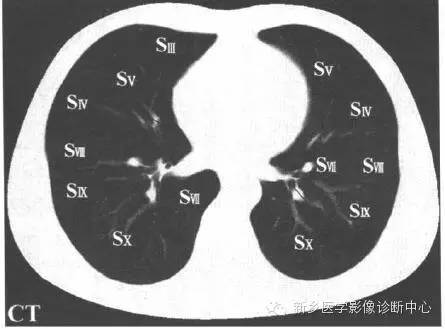 胸部横断位解剖+详细标注