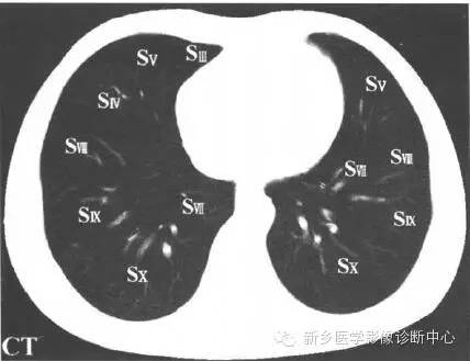 胸部横断位解剖+详细标注