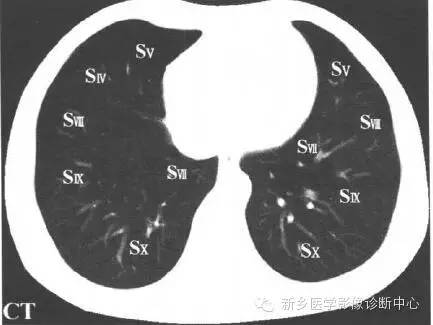胸部横断位解剖+详细标注