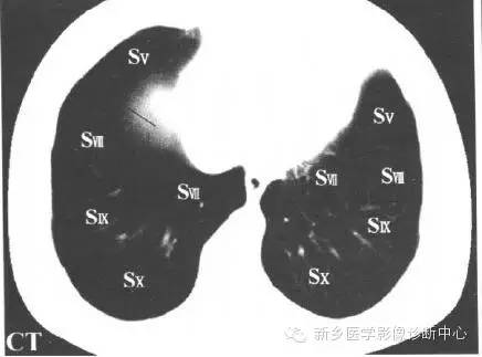 胸部横断位解剖+详细标注