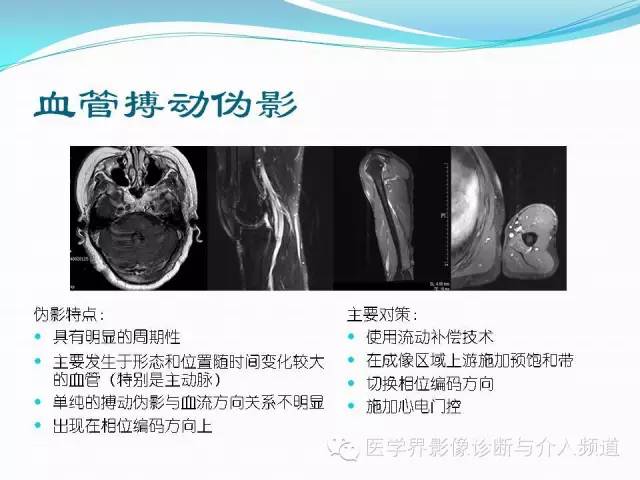 【PPT】磁共振常见伪影及对策