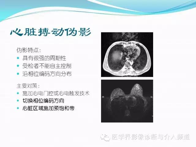 【PPT】磁共振常见伪影及对策