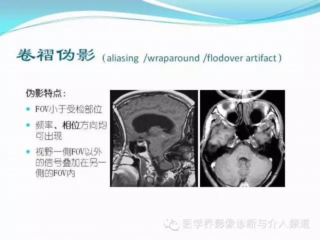 【PPT】磁共振常见伪影及对策