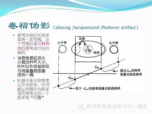 【PPT】磁共振常见伪影及对策