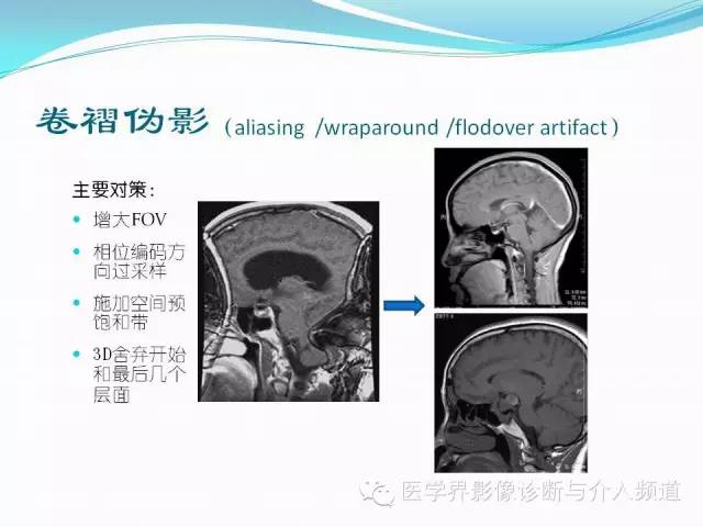 【PPT】磁共振常见伪影及对策