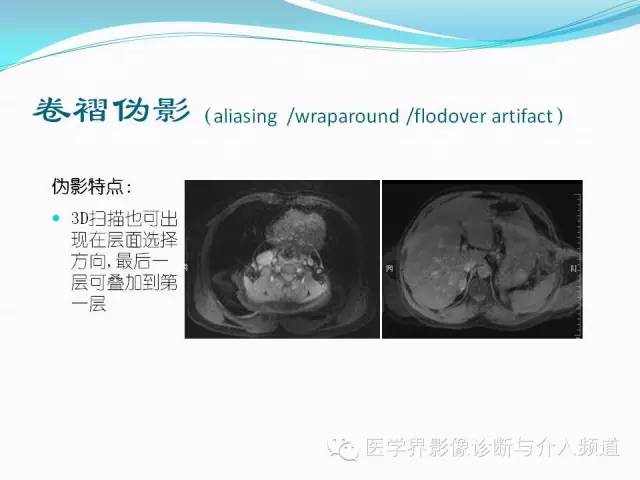【PPT】磁共振常见伪影及对策