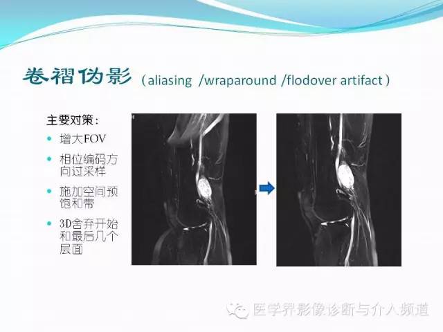 【PPT】磁共振常见伪影及对策