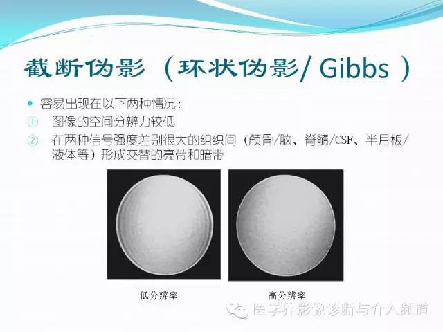 【PPT】磁共振常见伪影及对策