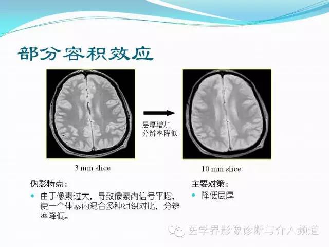 【PPT】磁共振常见伪影及对策