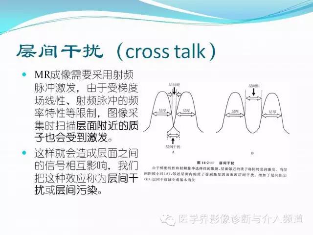 【PPT】磁共振常见伪影及对策