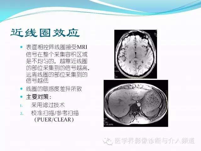 【PPT】磁共振常见伪影及对策