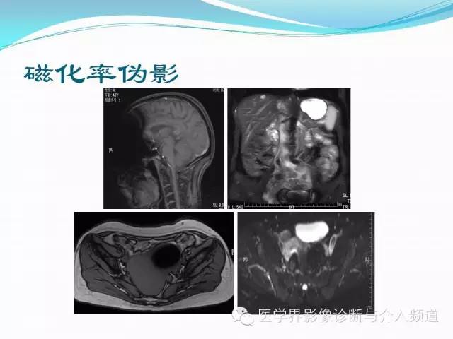 【PPT】磁共振常见伪影及对策