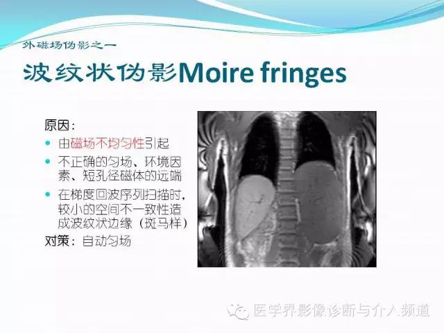 【PPT】磁共振常见伪影及对策