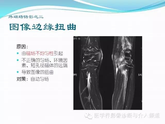 【PPT】磁共振常见伪影及对策